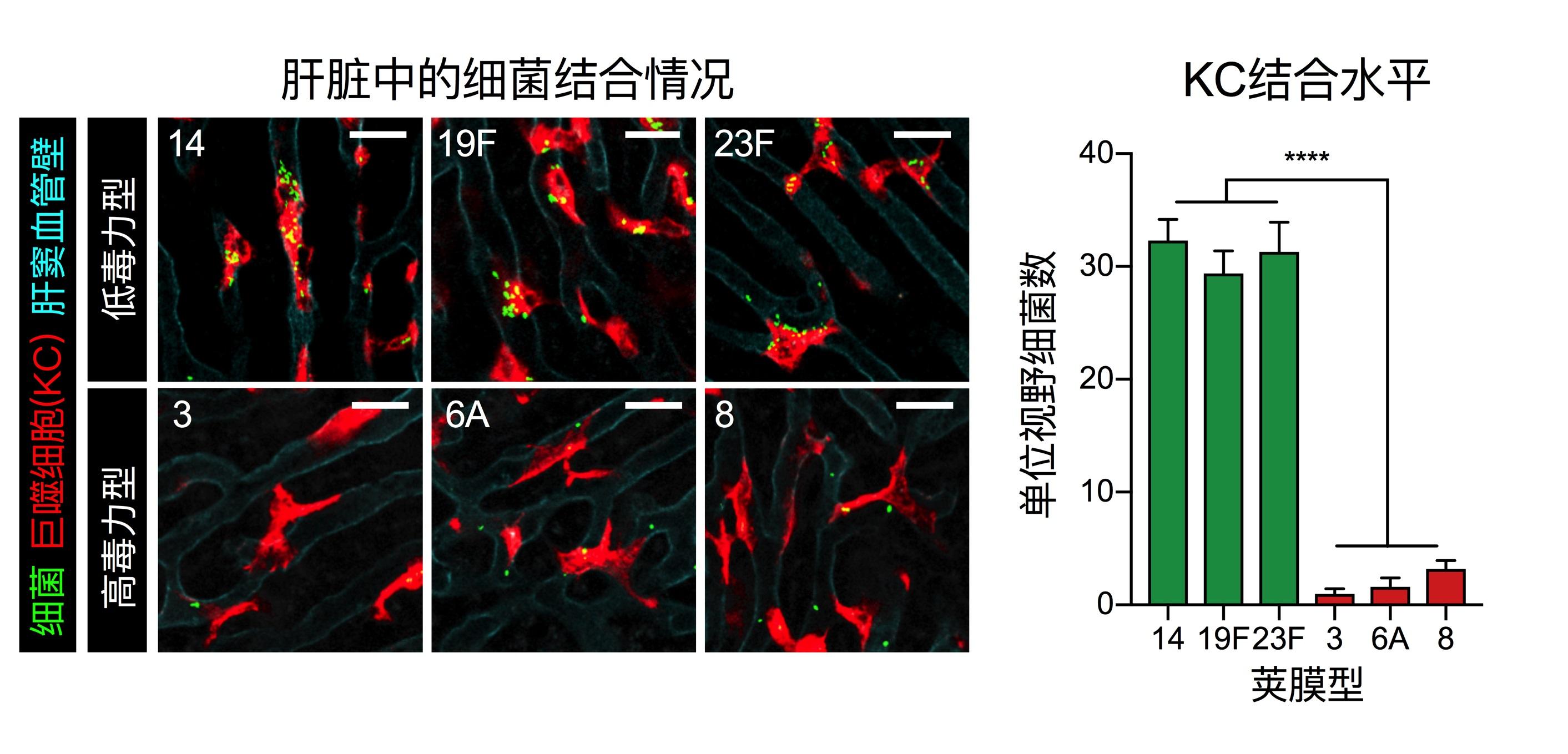 20220309-科研成果-安浩然-不同荚膜型肺炎链球菌与肝脏KC的相互作用.jpg 20220309-科研成果-安浩然-不同荚膜型肺炎链球菌与肝脏KC的相互作用.jpg
